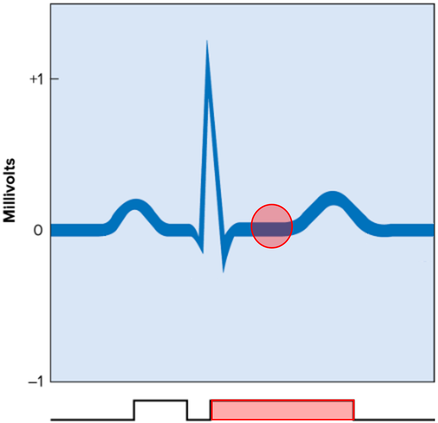 • A segment of the ECG.

• Represents ventricular contraction after ventricular depolarization.