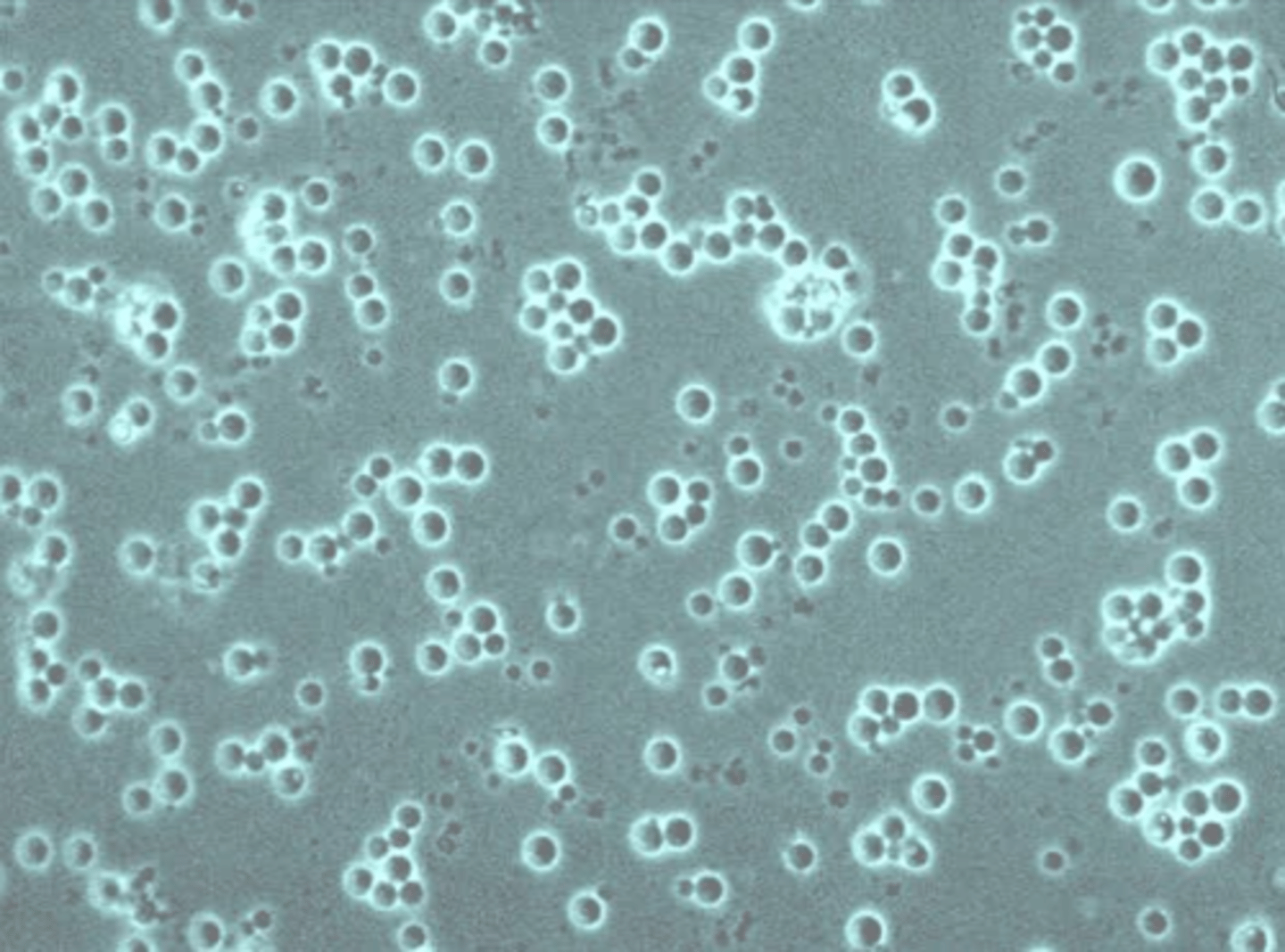 <p>common name of unicellular fungi</p>