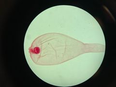 <p>What is the genus species of this larval tapeworm? It is one of the most common tapeworms and its definitive hosts are dogs and wild dogs</p>