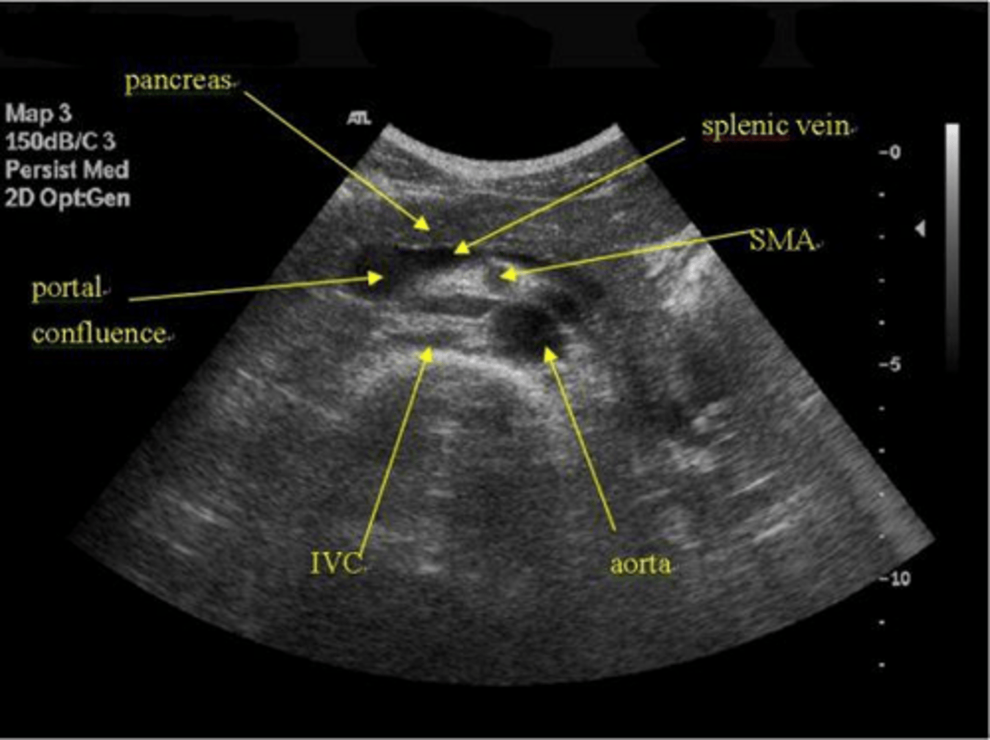 <p>It can be homogeneous or heterogeneous depending on the amount of interlobular fat.</p>