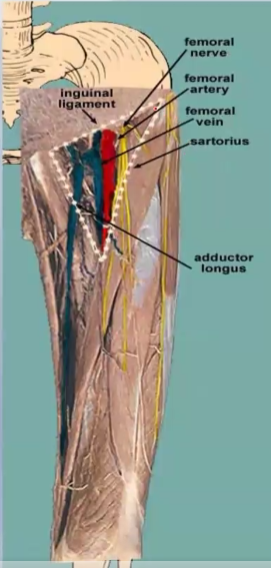 <p>Name the <strong>boundaries</strong> of the <em>femoral triangle</em>:<br>Laterally - _________<br>Medially - _________<br>Superior - _________<br>Floor - _________<br>Roof - _________</p>