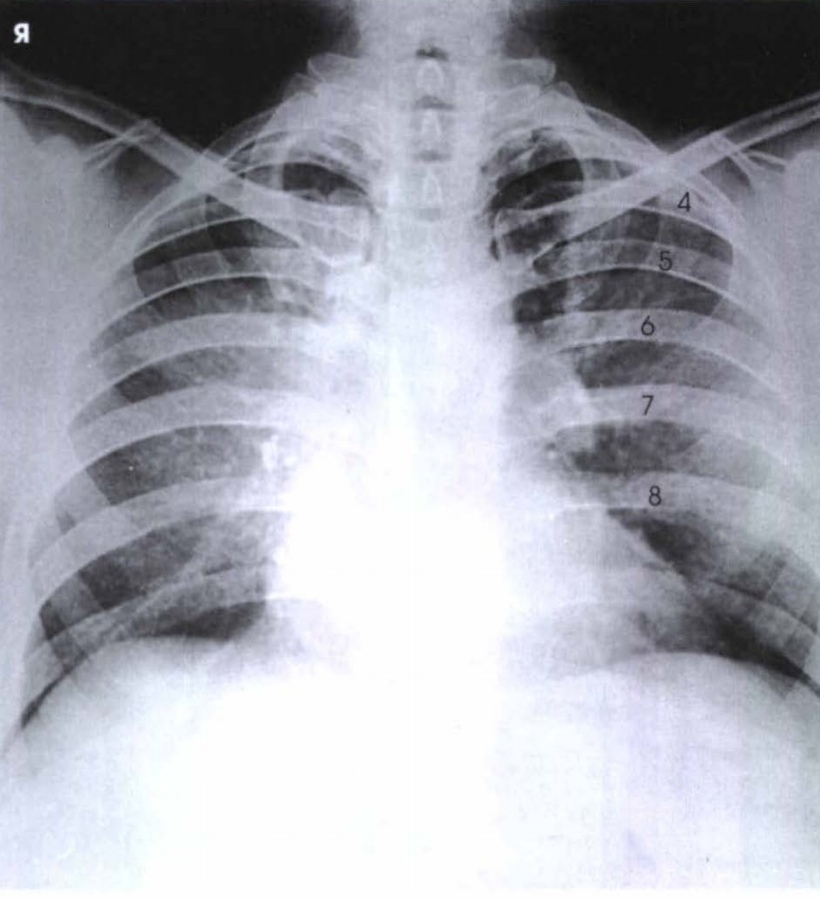 term image
