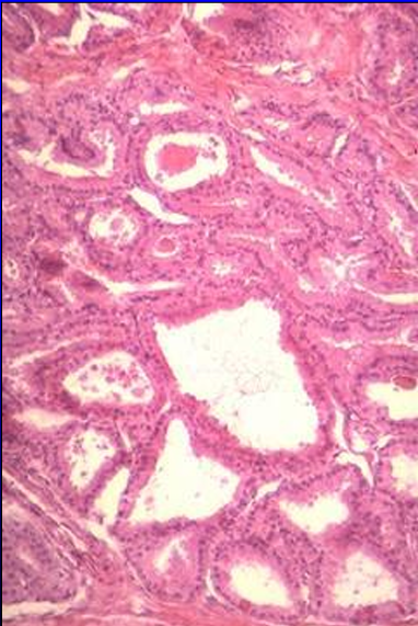<p>Identify the structure:</p><p>Lined by:</p>