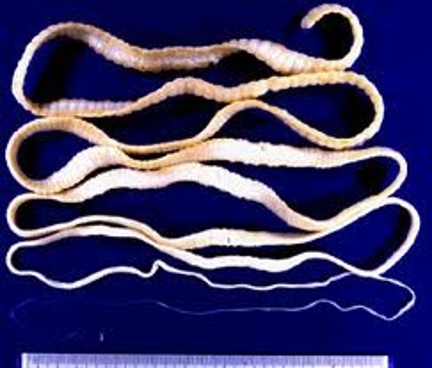 <p>parasitic tapeworm</p>