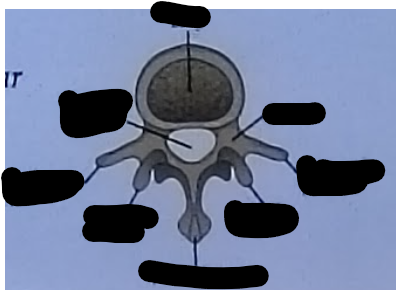 <p>Lumbar vertebrae parts&nbsp;</p>