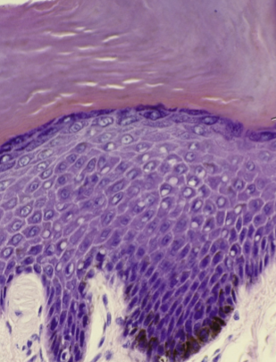 <p>Strata</p>