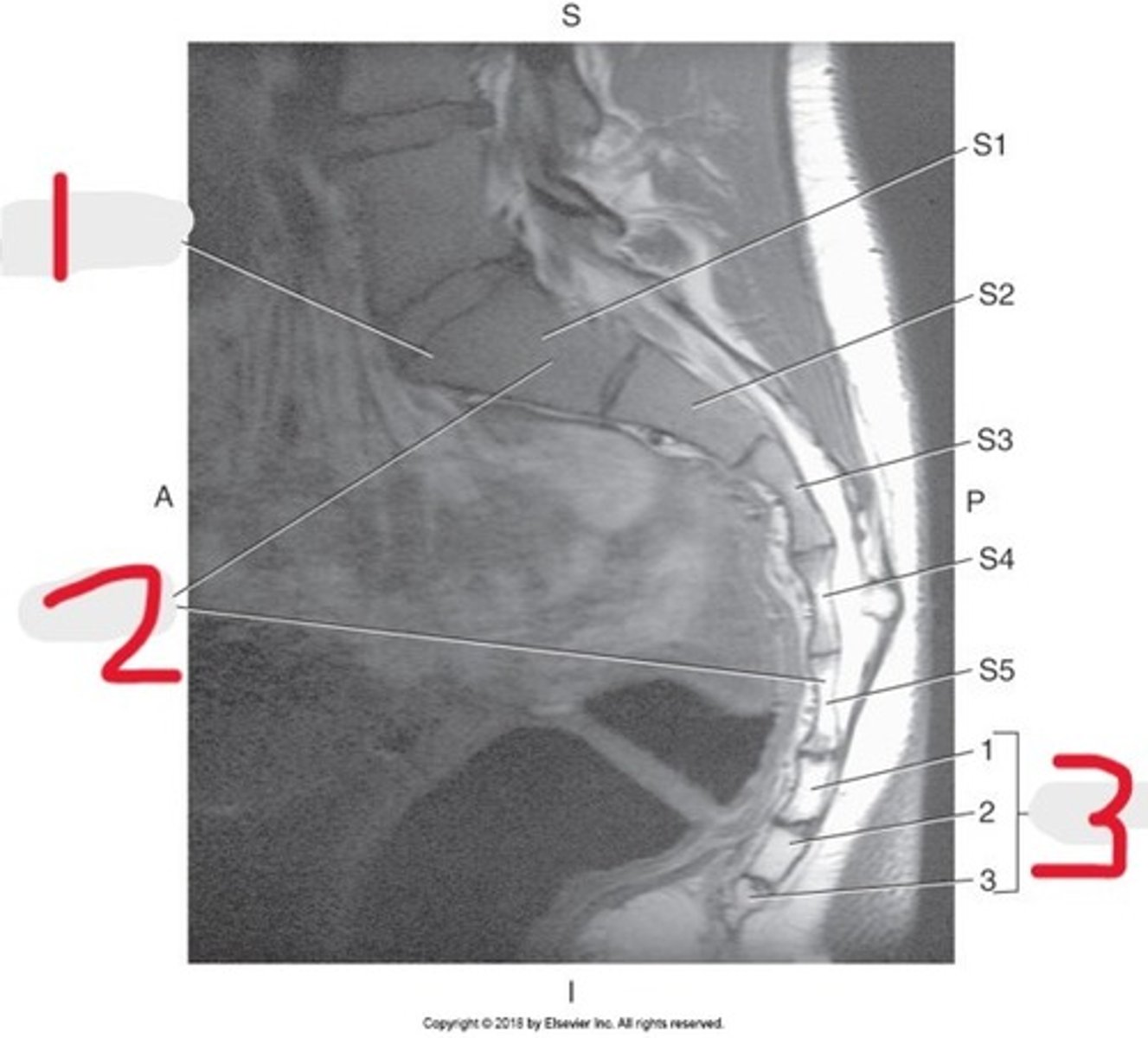 <p>Name all numbered structures</p>