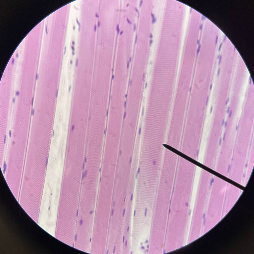 <p>What muscle is this?</p>