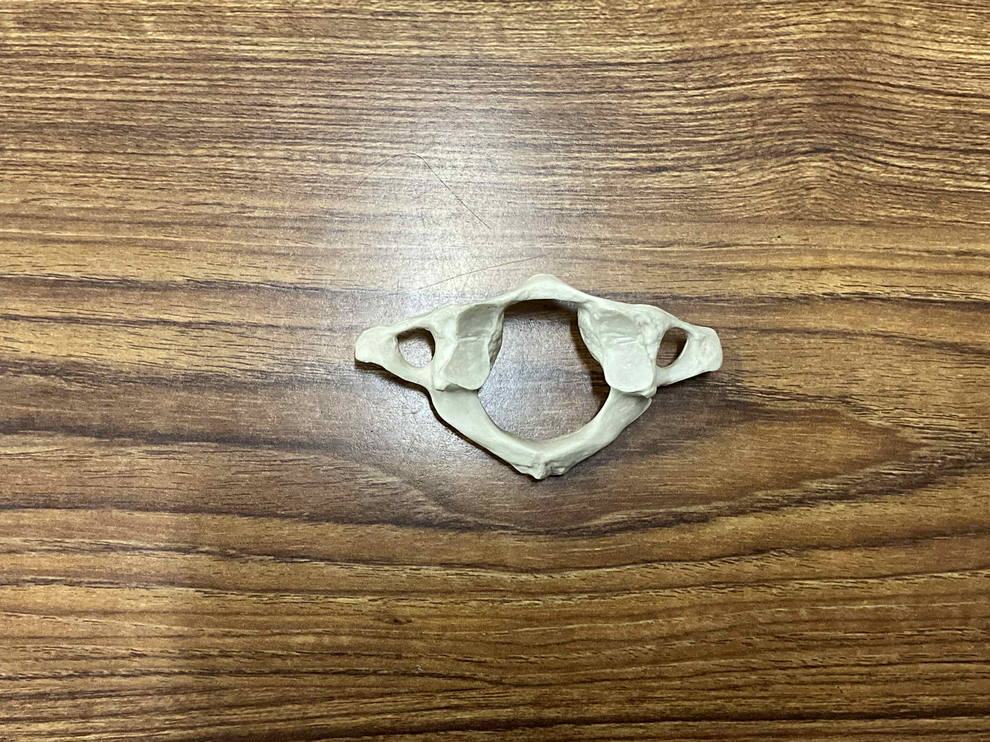 <p>Name this bone (specific)</p>