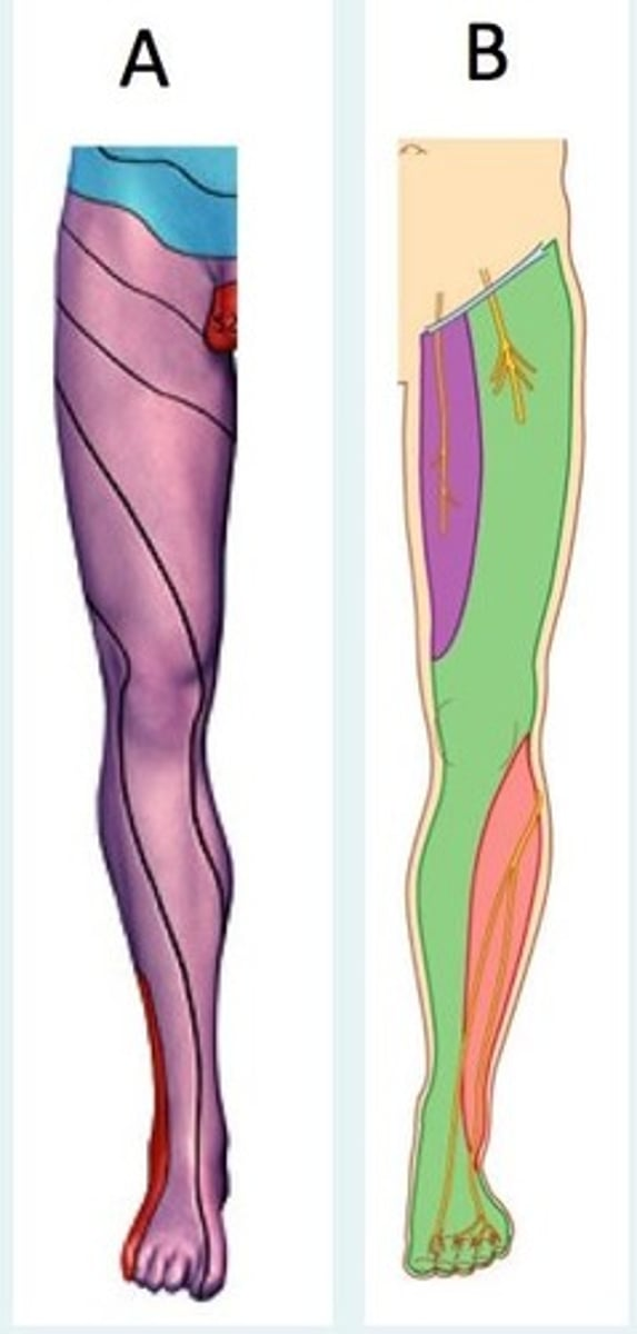 <p>If you have complete numbness in one of the shaded areas in the image labelled ___, this likely points to a peripheral nerve being damaged and would likely include sensory and motor loss.</p>