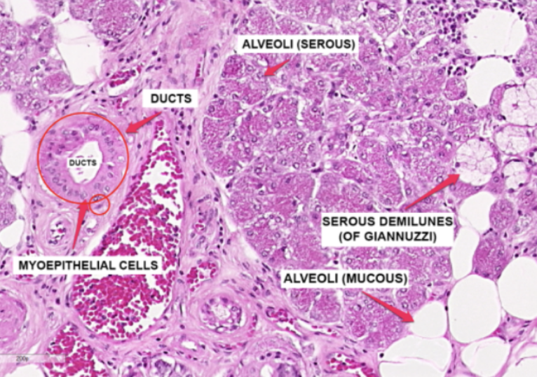 <p>What organ specimen is shown in this slide?</p>
