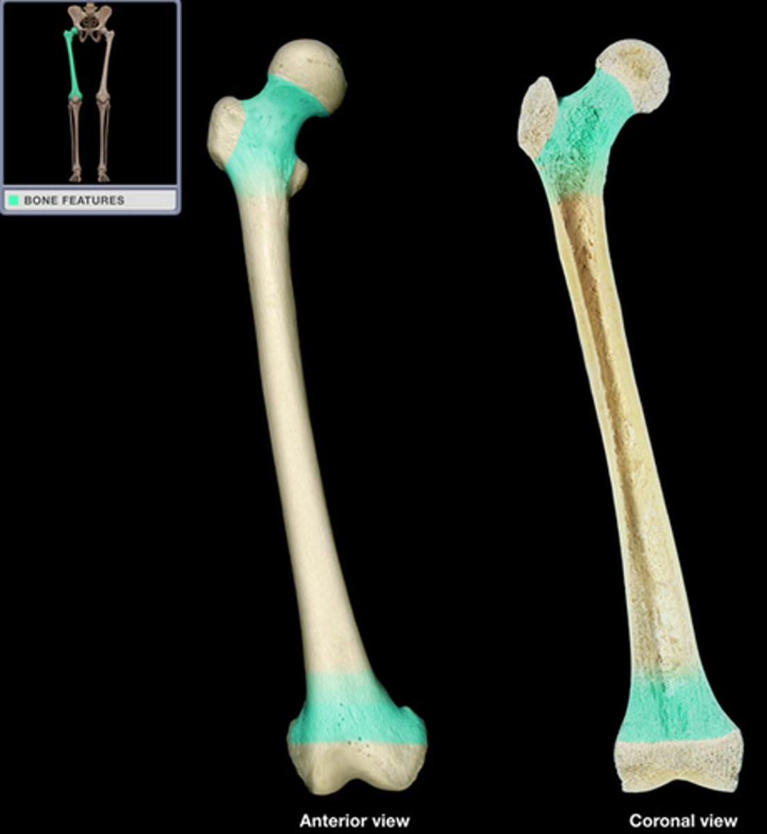 <p>What part of the long bone is this?</p>