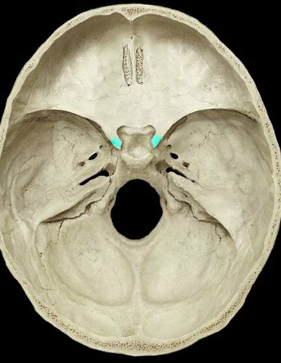 <p>together the clinoid processes deepend the sella turcica and serve as points of attachment for the tentorium cerebelli</p>