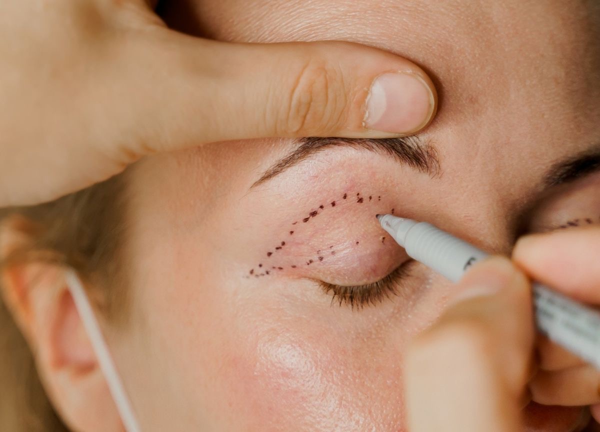 <p>eyelid </p>