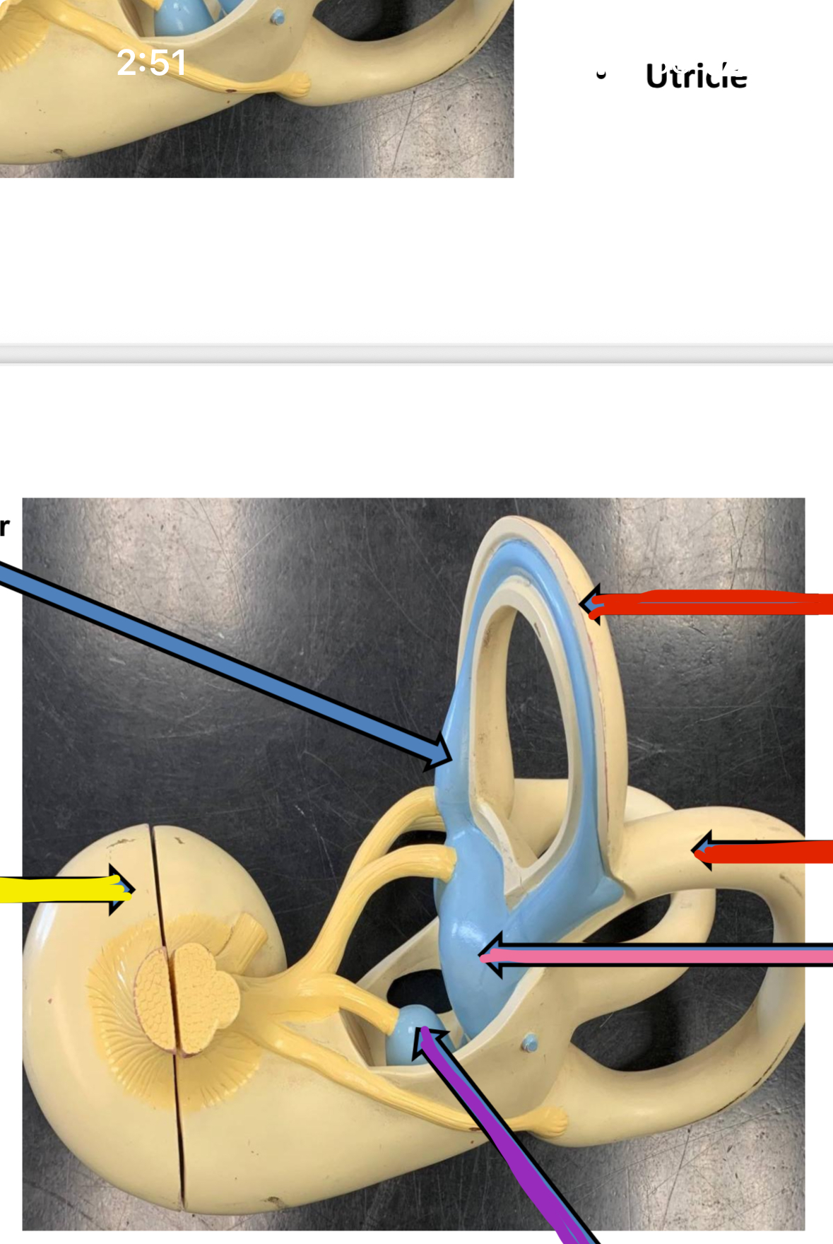 <p>Purple points to what part of the vestibular complex</p>