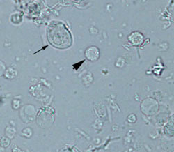 <p>granular, glitter cells</p>