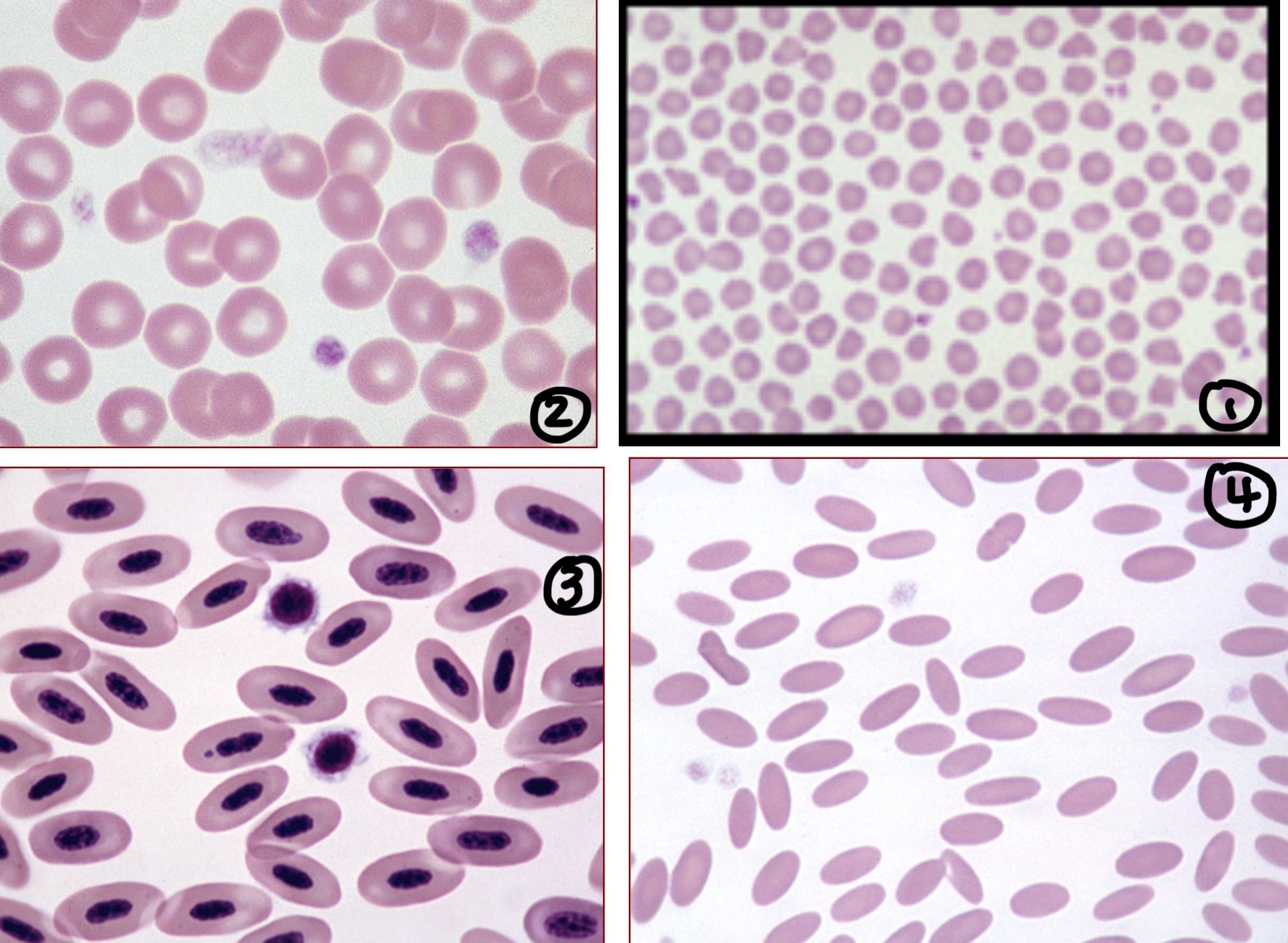 <p>Identify species associated with each RBC </p>
