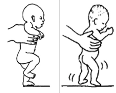 <p>This is an example of what reflex…</p>