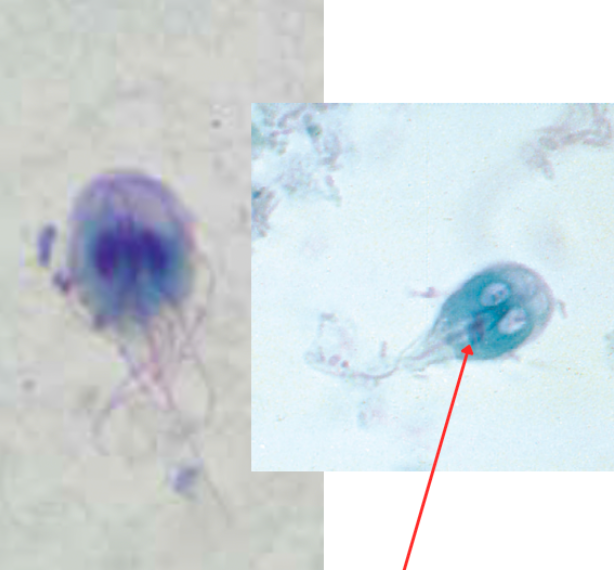 <ul><li><p style="text-align: justify;"><span style="background-color: transparent;"><span>Identify the organism. Give genus and species.</span></span></p><ul><li><p style="text-align: justify;">(1)</p></li></ul></li><li><p style="text-align: justify;"><span style="background-color: transparent;"><span>What is the morphologic stage of the organism?</span></span></p><ul><li><p style="text-align: justify;">(2)</p></li></ul></li><li><p style="text-align: justify;"><span style="background-color: transparent;"><span>What is the characteristic motility pattern?</span></span></p><ul><li><p style="text-align: justify;">(3)</p></li></ul></li><li><p style="text-align: justify;"><span style="background-color: transparent;"><span>Identify the structure pointed by the red arrow.</span></span></p><ul><li><p style="text-align: justify;">(4)</p></li></ul></li></ul><p></p>