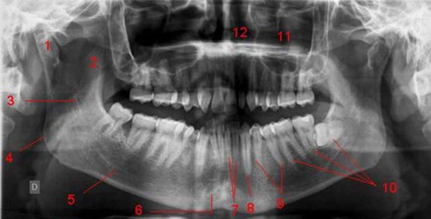 <p>number 11</p>