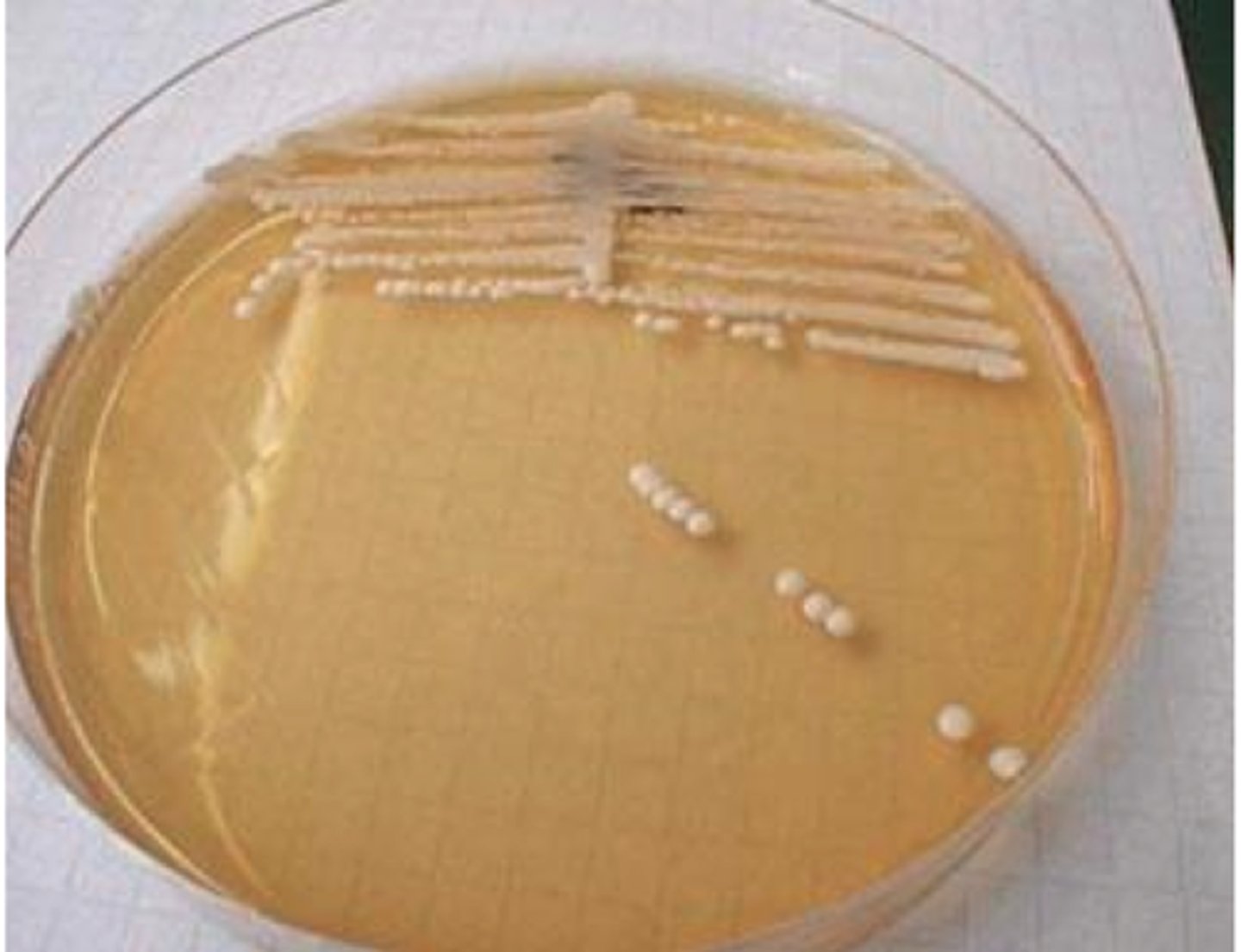 <p>Yeast-like:</p>