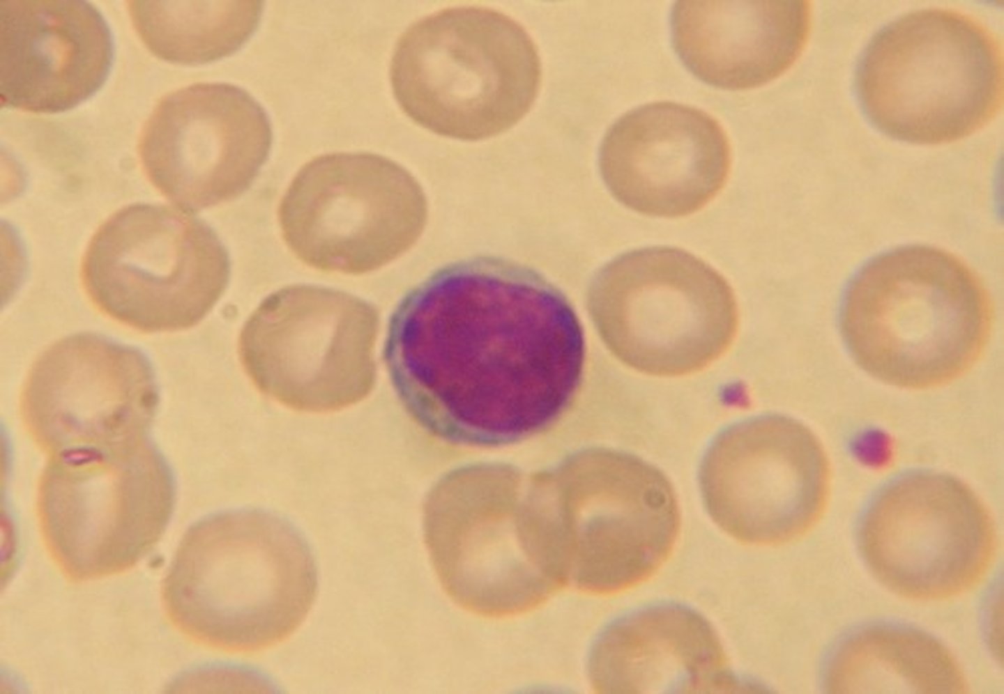 <p>invading organisms, chemical irritants, malignant cells, and senescent cells</p>