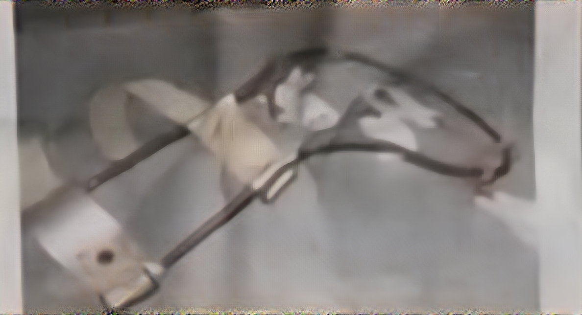 <p>Banjo Splint</p>