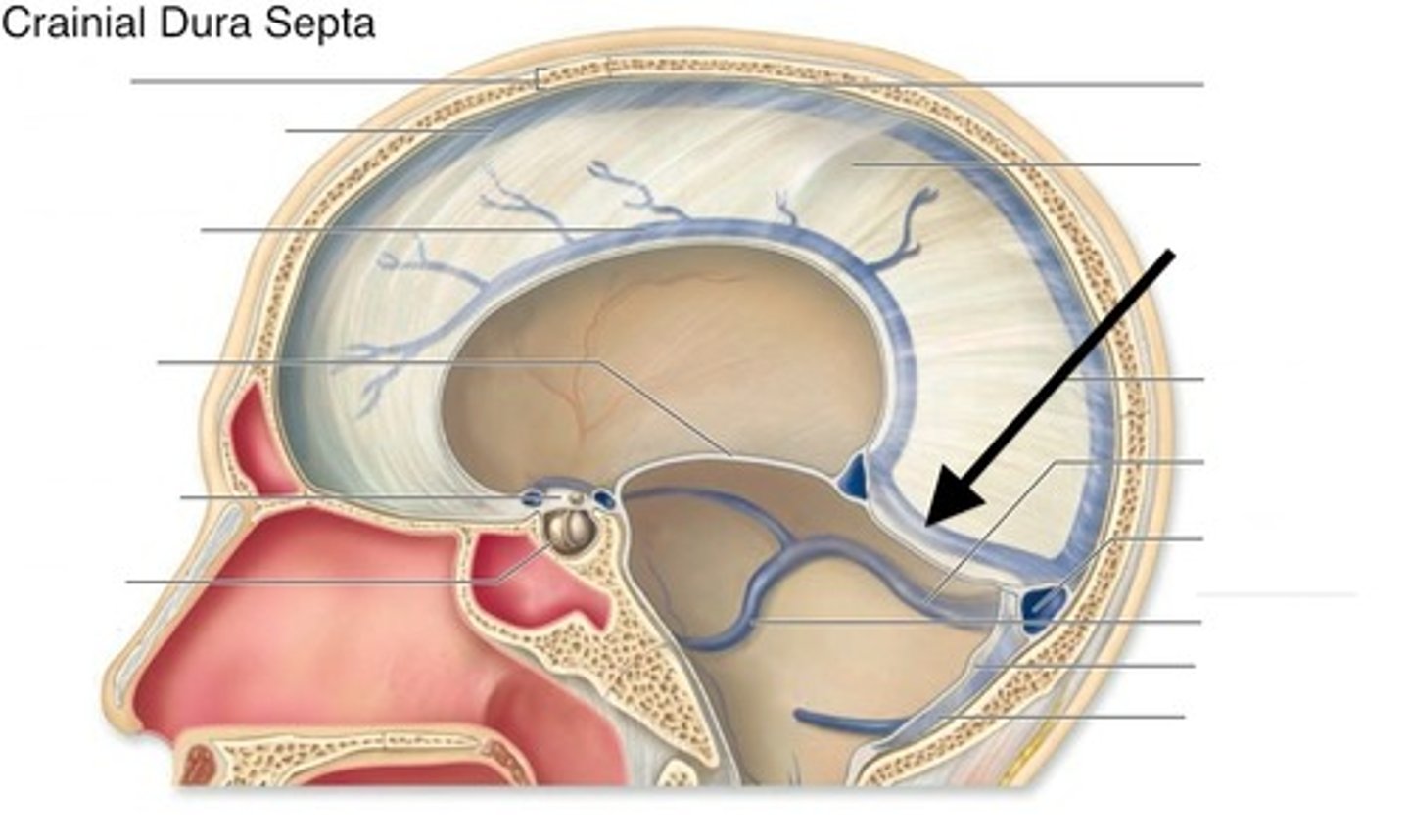 <p>straight sinus</p>