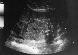 <p><span><span>During a late second-trimester screening examination, what does this image of the fetal abdomen most likely show:</span><strong><span><br></span></strong></span></p><p></p>