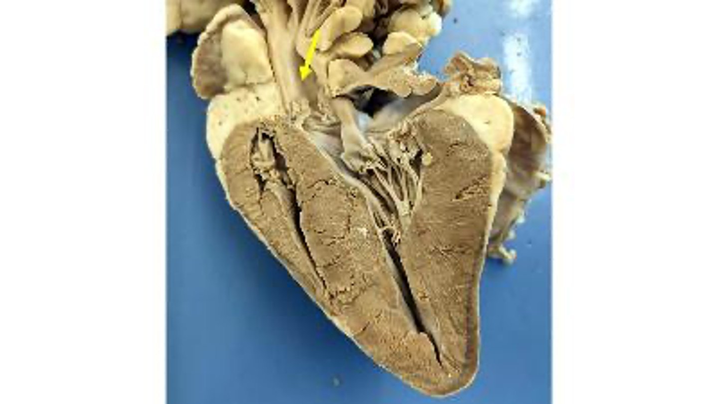 <p>Name the vessel</p>