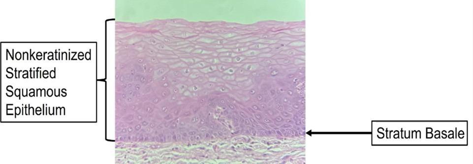 <p>Non-Keratinized stratified squamous epithelium </p><p>Location : Oral mucosa, vagina, esophagus</p>