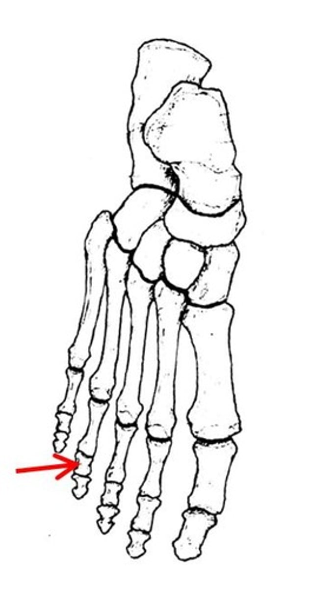 <p>ID specific bone</p>