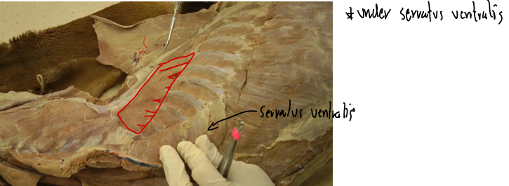 <p><span>Serratus Dorsalis (Thoracic wall)</span></p>