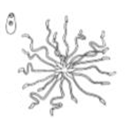 <p>Identify the type of Cercaria based on its Tail</p>
