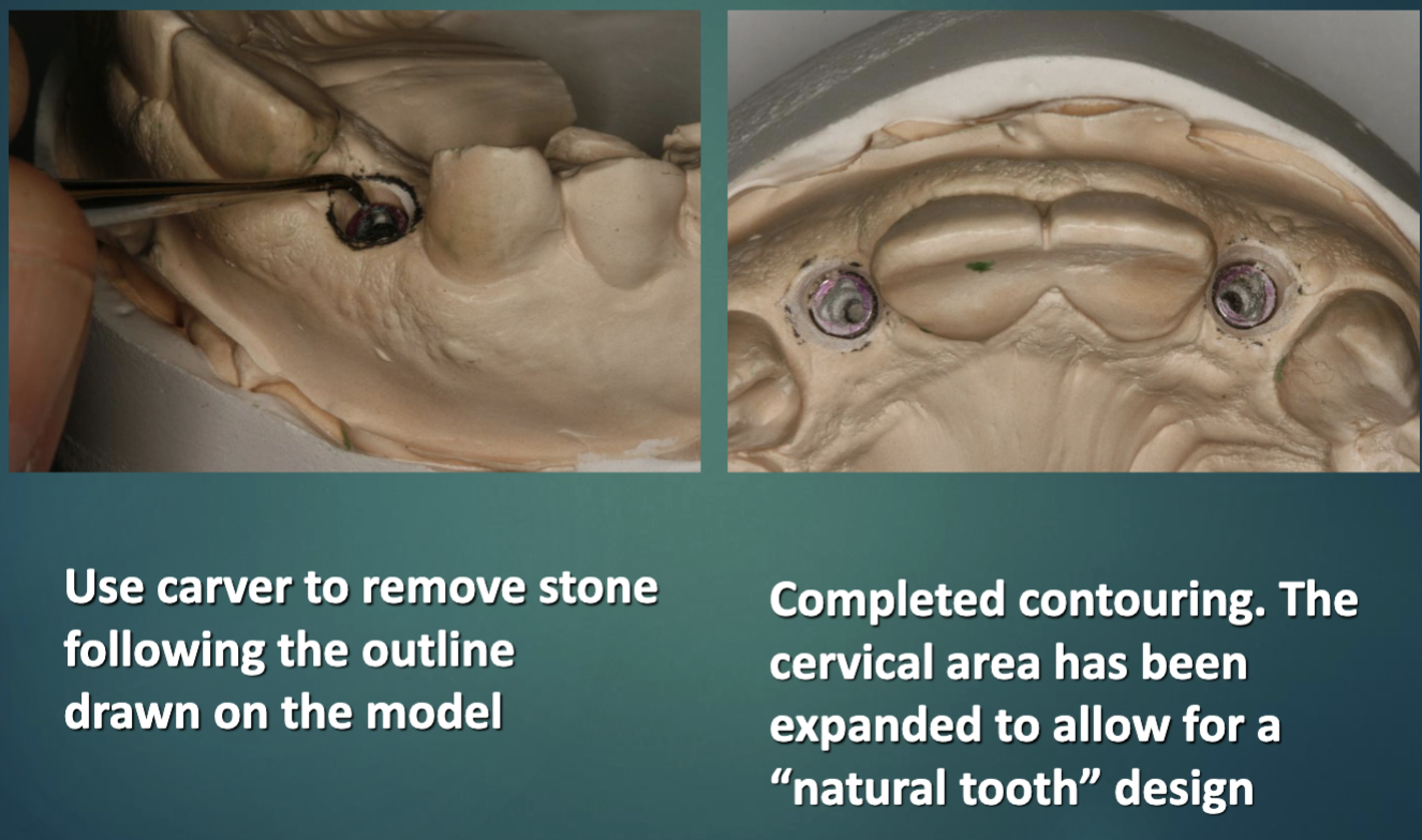 <ul><li><p>use pencil to outline profile on model </p></li><li><p>use carver to remove stone following outline </p></li></ul><p></p>