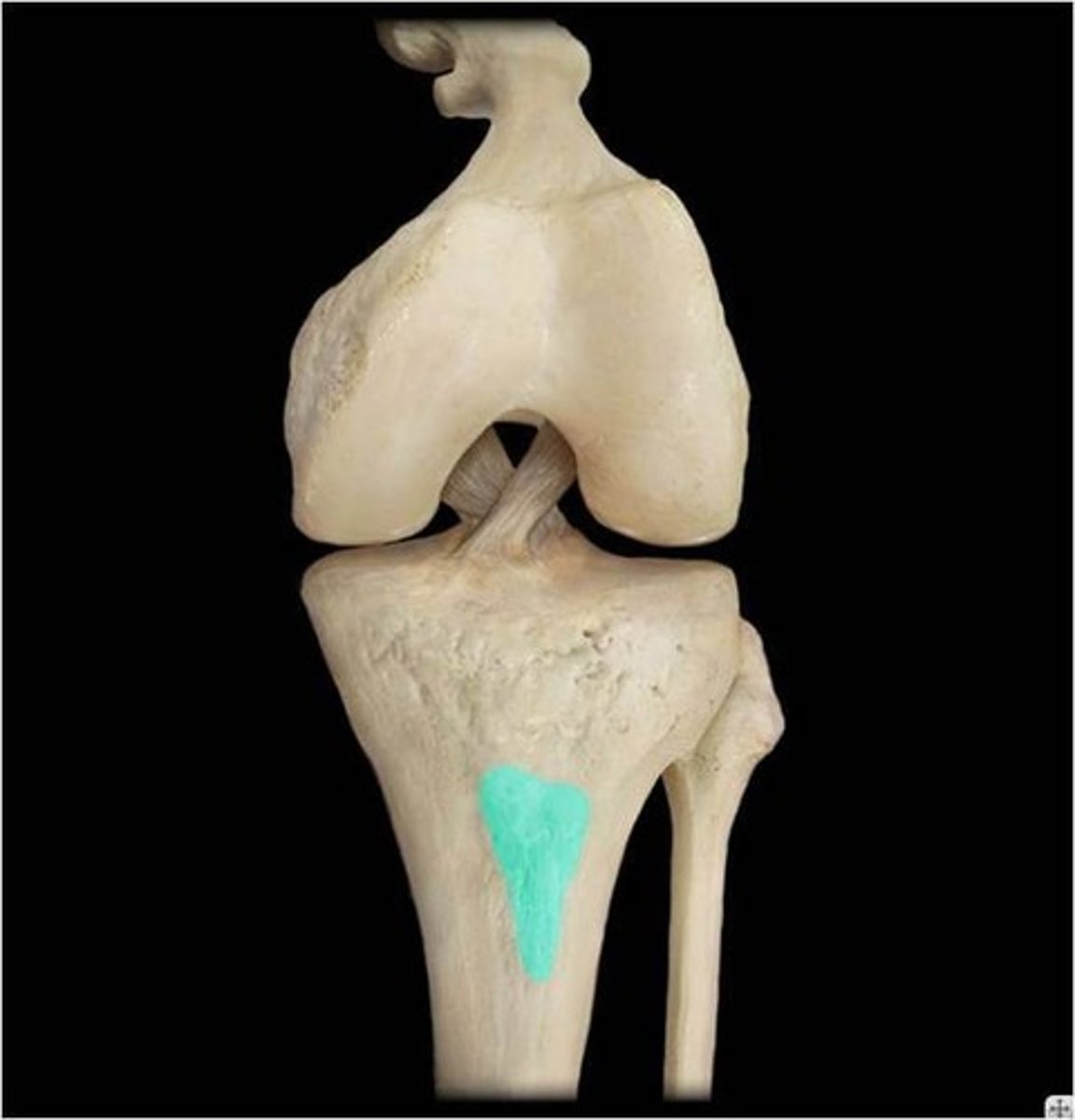 <p>A small rough bump or process is known as a(n)...</p>