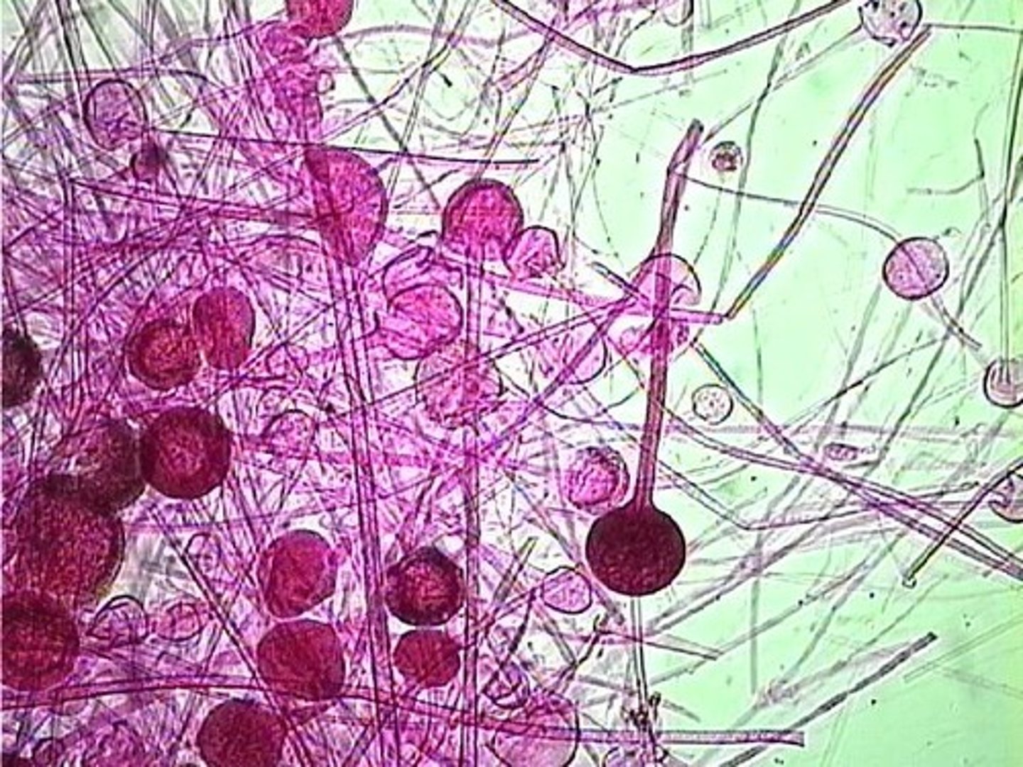<p>Bread mold (rhizopus)</p>