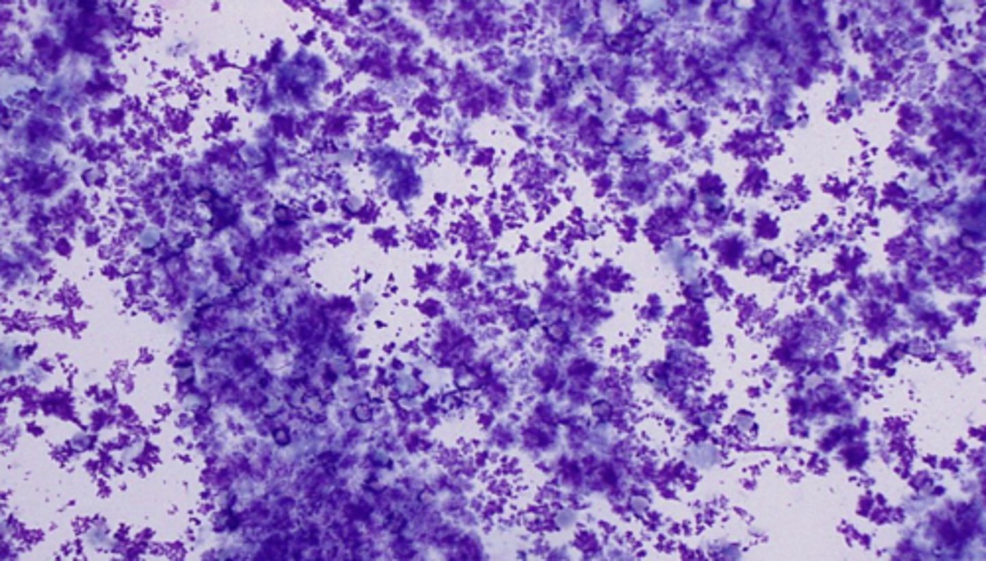 <p>What has caused the appearance of this slide?</p>