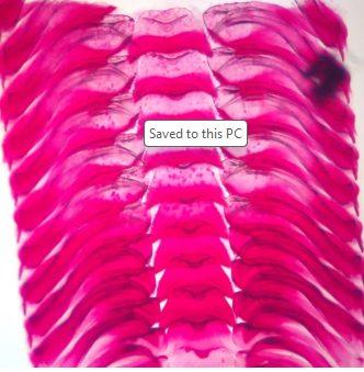<p>Name this structure and its function. What Phylum and Class(es) can this be found in? </p>