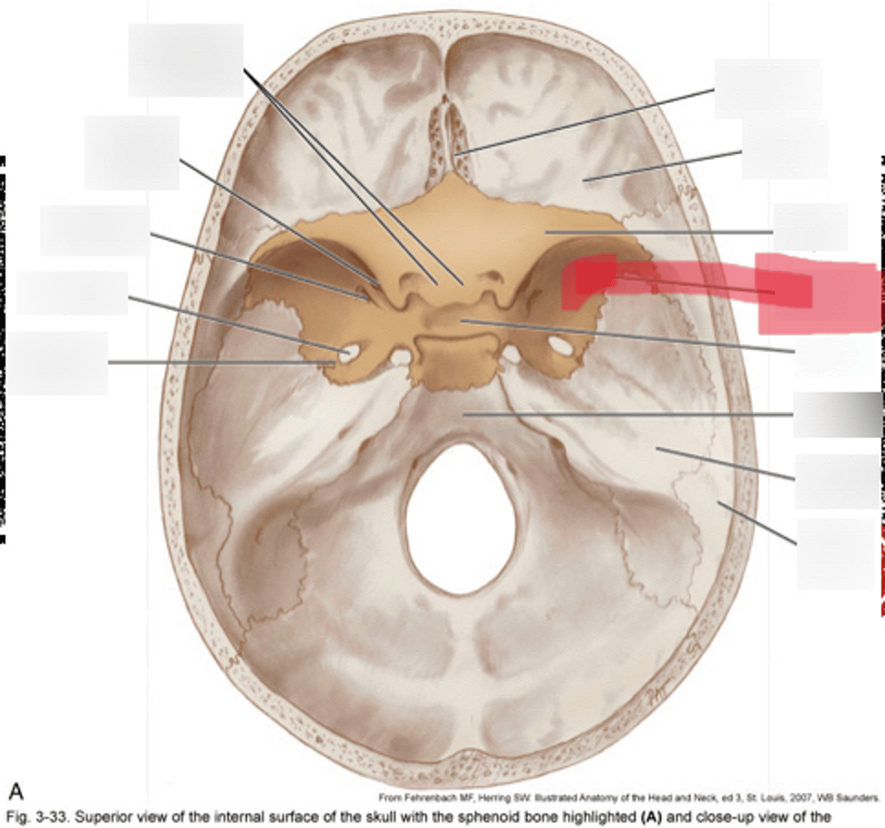 <p>Greater wing of the sphenoid bone</p>