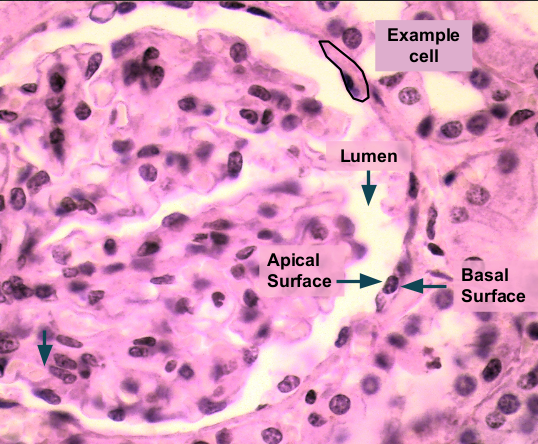 <p>rapid diffusion;&nbsp; kidney TUBULES, alveoli of lungs, blood vessels&nbsp;</p>