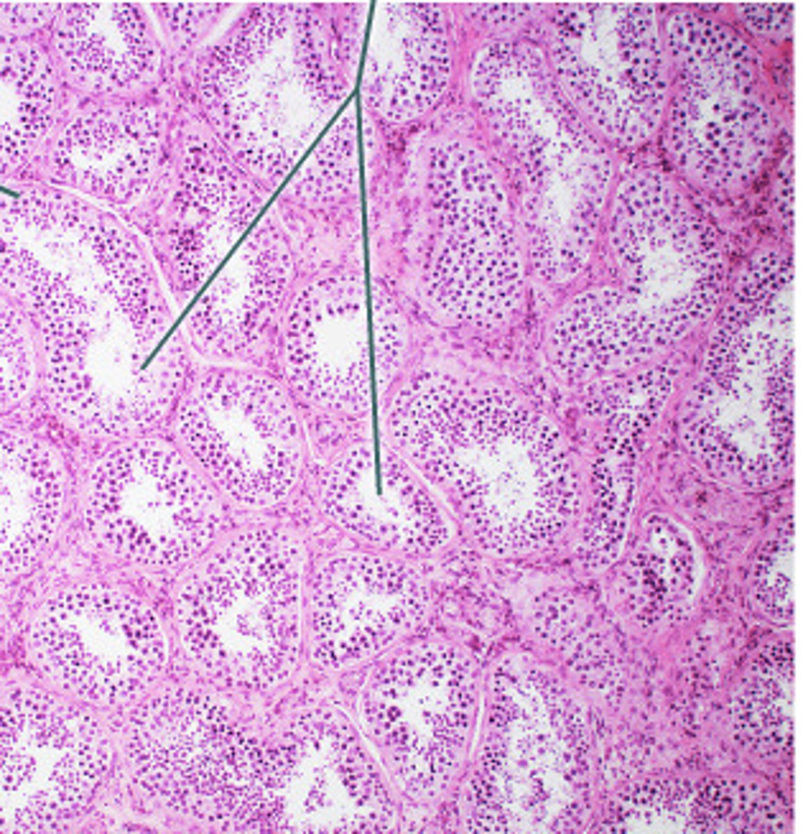 <p>Fx: site of sperm production in the testes.</p>