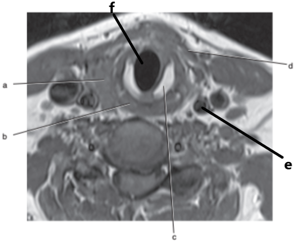 <p>What is letter c ?</p>