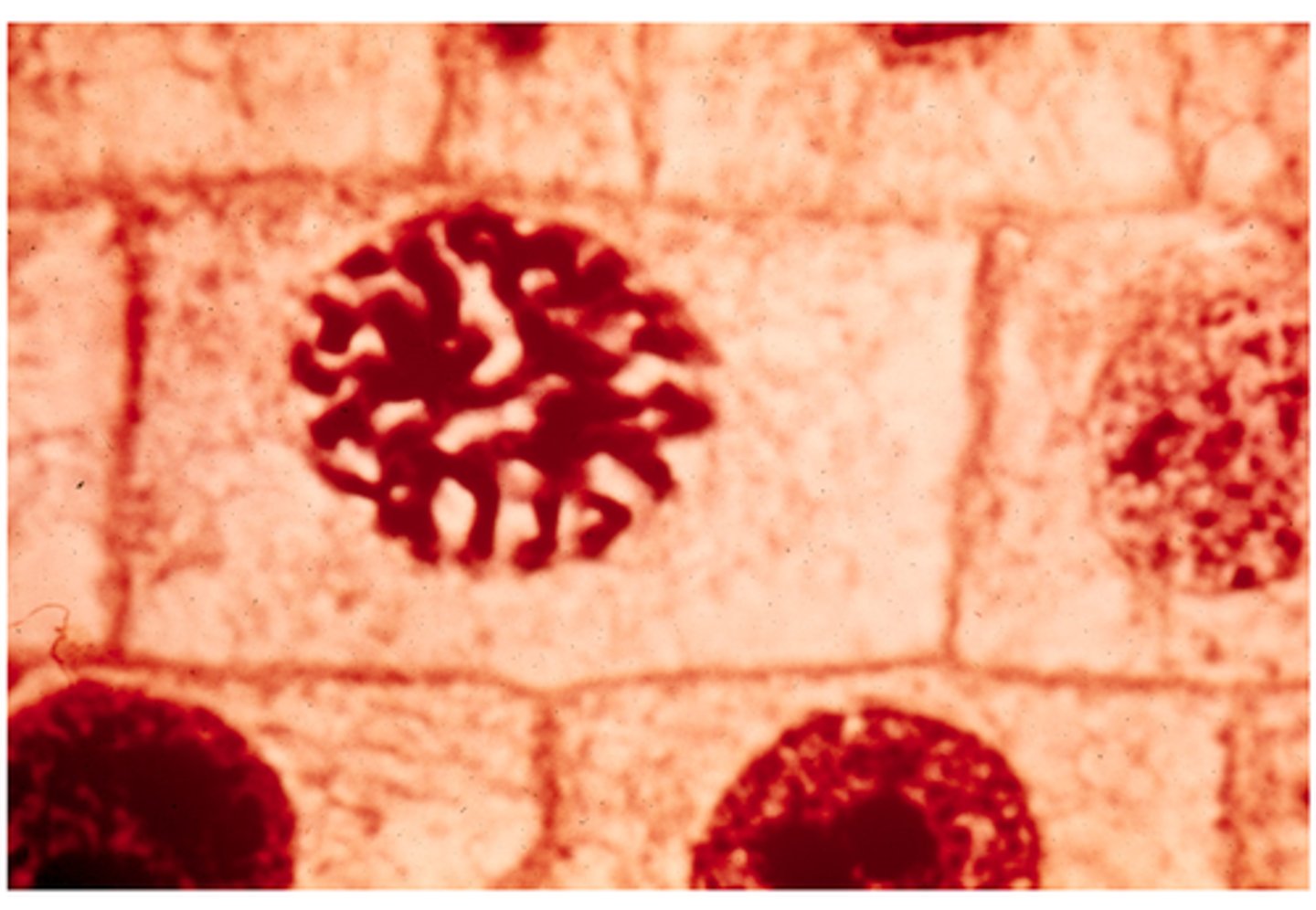 <p>This shows _______ in onion cells.</p>
