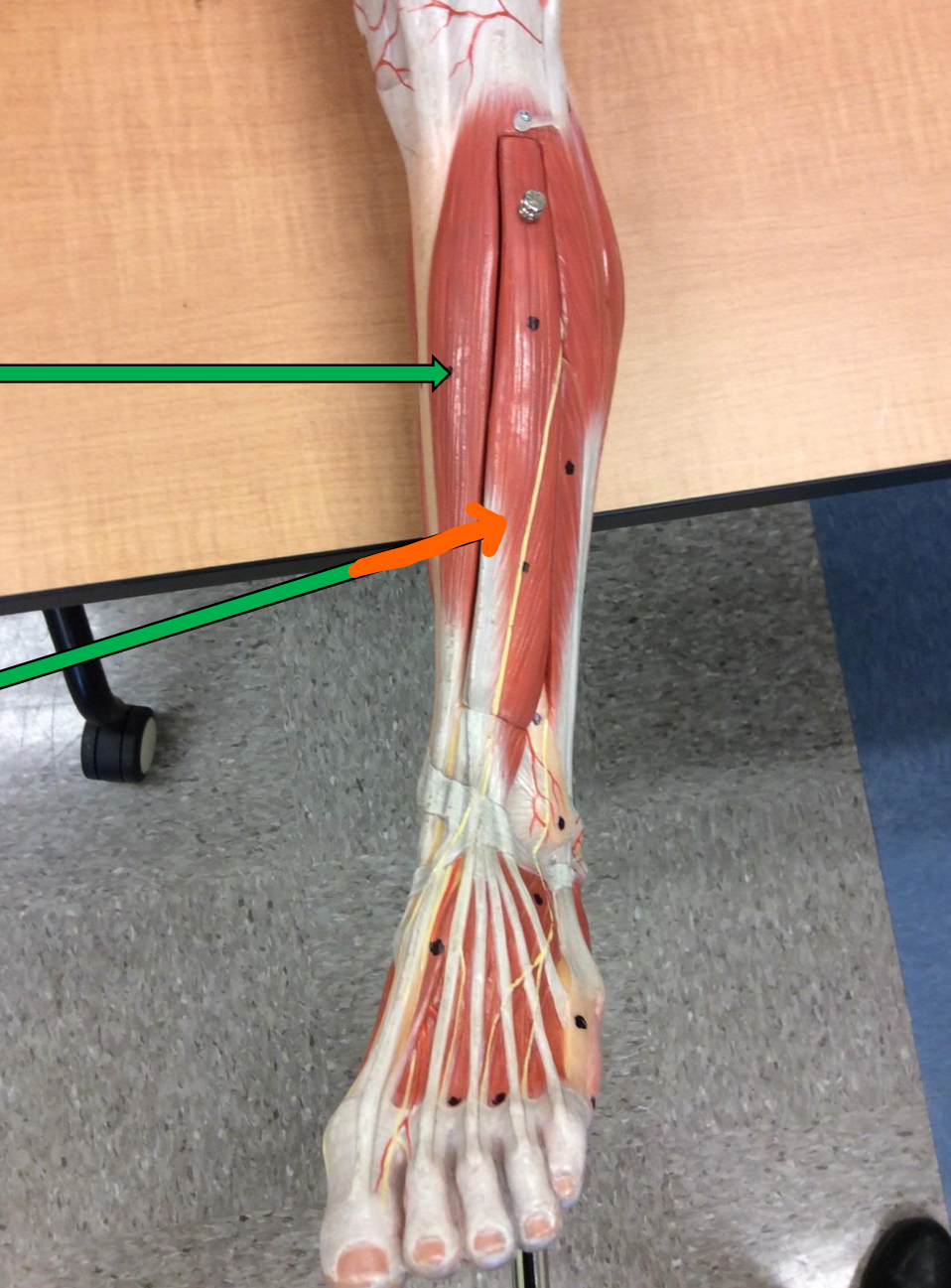 <p>Identify this muscle?</p>