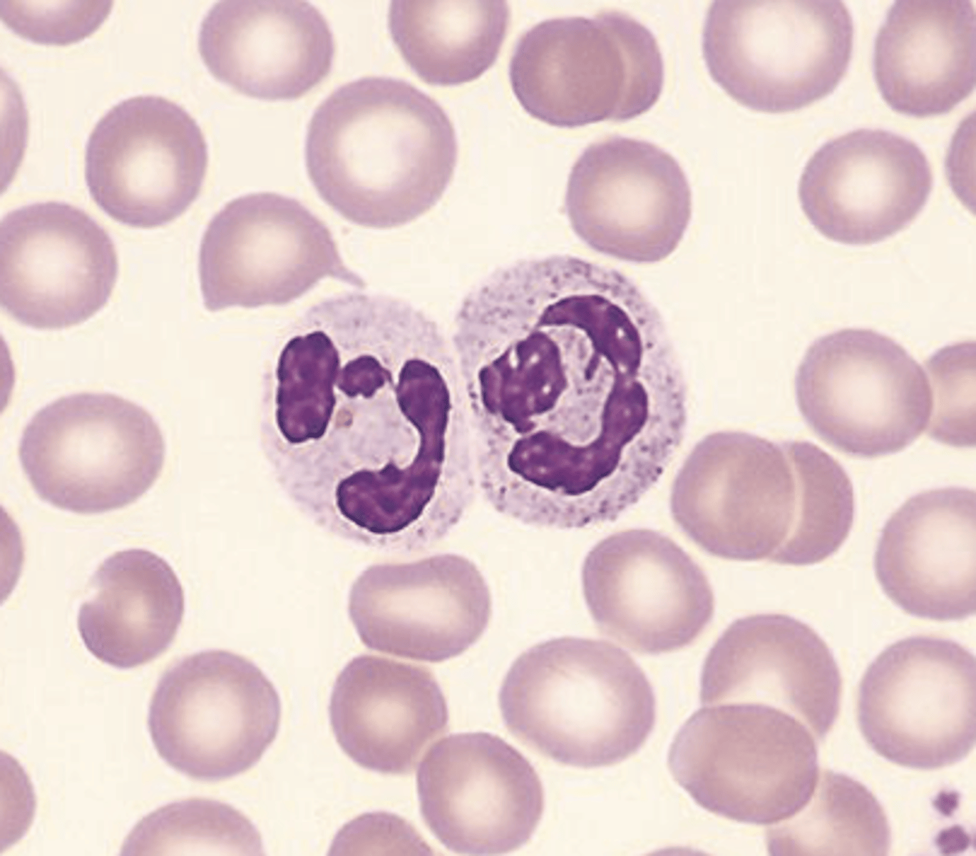 <p>&gt; has to to five lobes in the nucleus</p><p>&gt; serves as defense against infections.</p><p>&gt; cytoplasm stains pink</p><p>&gt; granules stain neutral or pink</p><p>&gt; secondary granules: lysosomes that contain alkaline phosphatase</p>