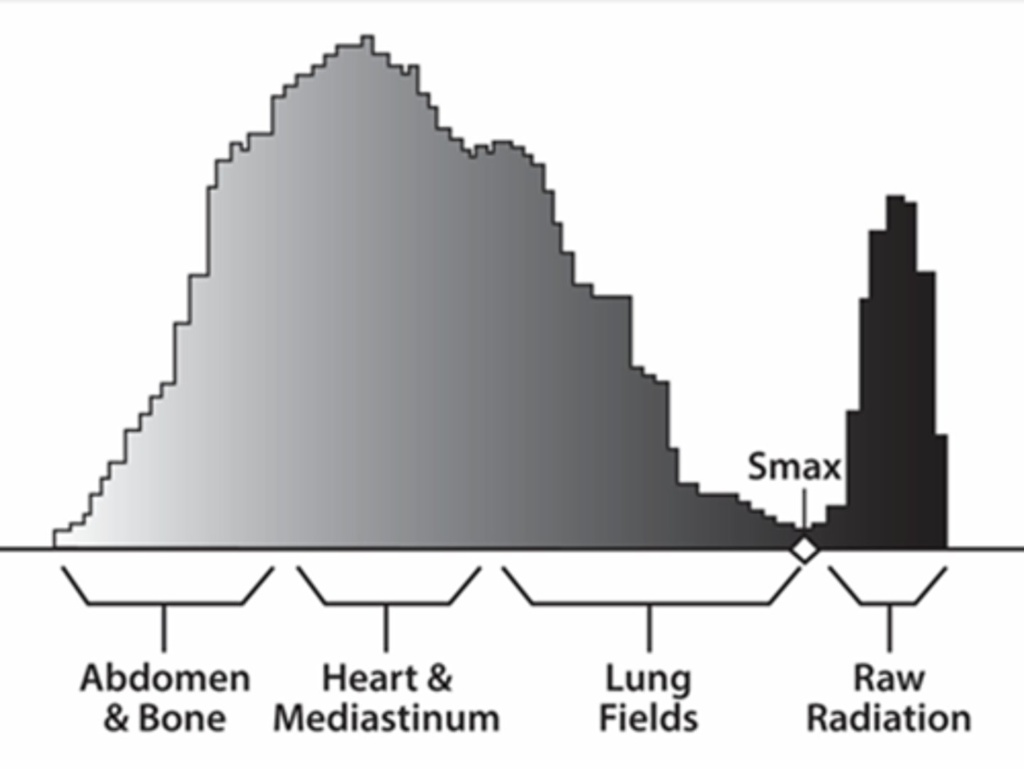 <p>Abdomen: Left, brighter</p><p>Mediastinum: Middle</p><p>Lung: Right, darker</p><p>Background density is represented by spike to the right</p>