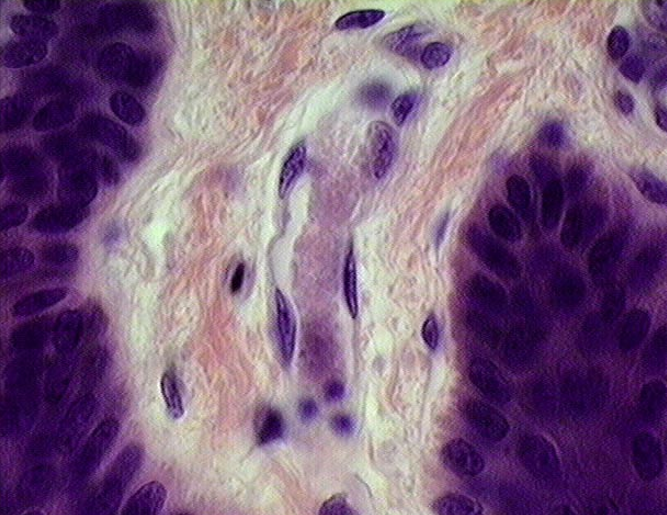 <p>Capillary</p>