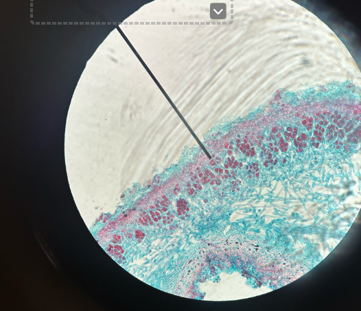 <p>-Upper blue layer: protective hyphae outer layer</p><p>-Red layer below: Algae (shows mutualistic relationship)</p><p>-Middle blue: loose fungal hyphae</p>
