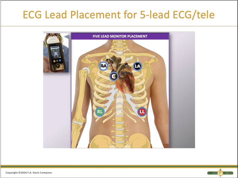 <p>Snow WHITE is over GREEN grass<br>BLACK smoke over a RED fire<br>Always keep CHOCOLATE close to your heart </p>